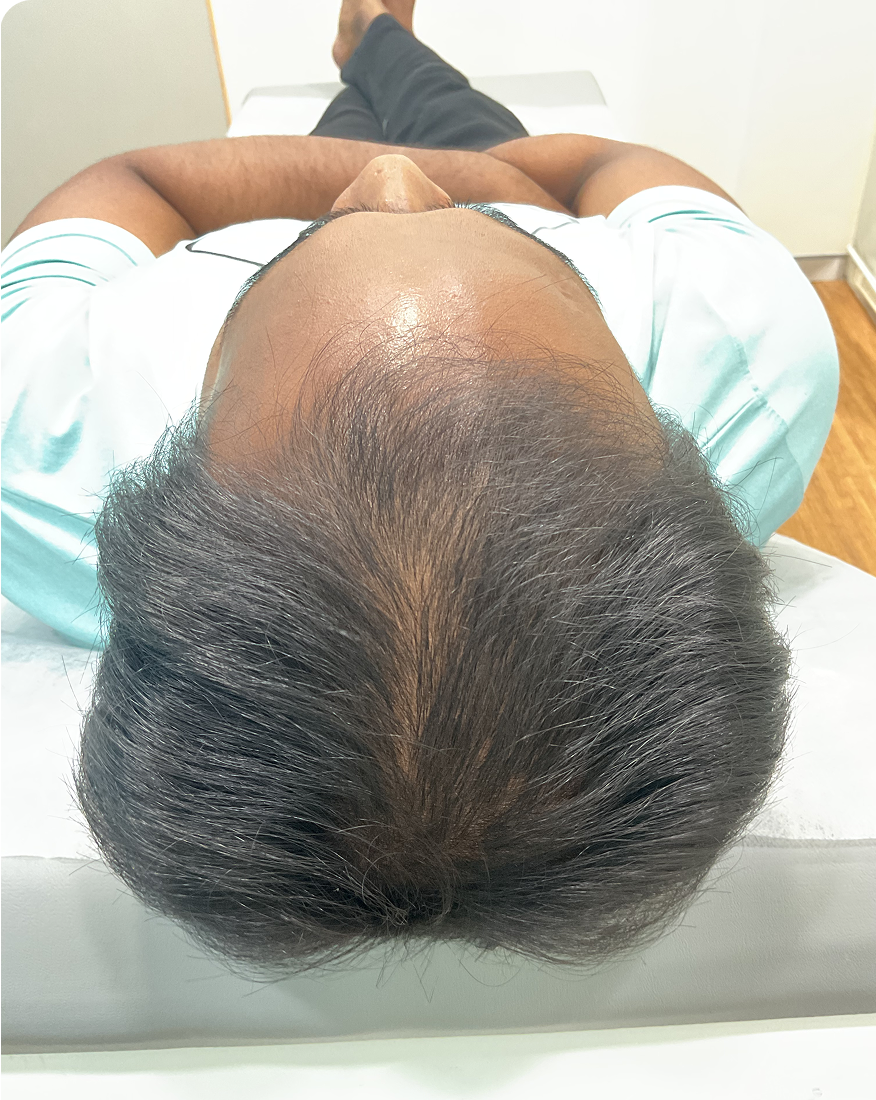 Before